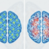 Autism and Schizophrenia
