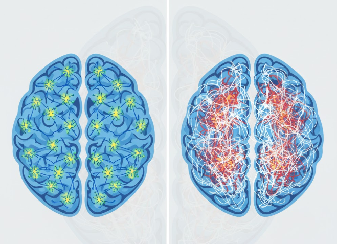 Autism and Schizophrenia
