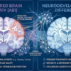 is autism brain damage